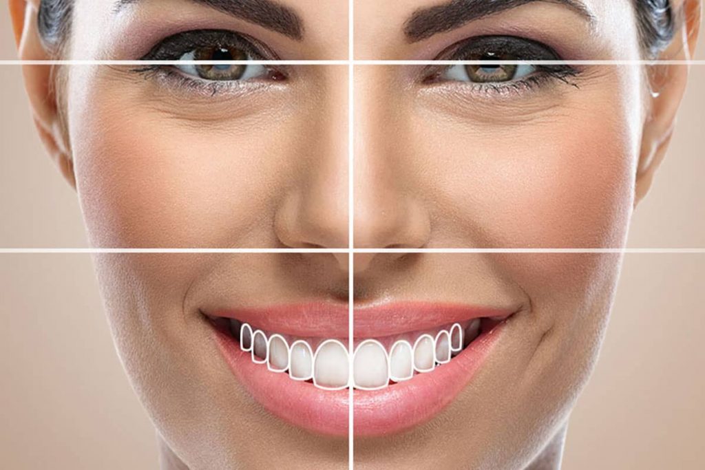 Kuşadası Diş Kliniği